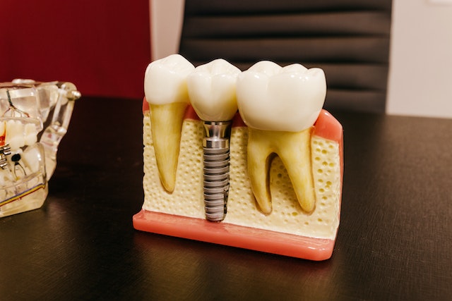 teeth